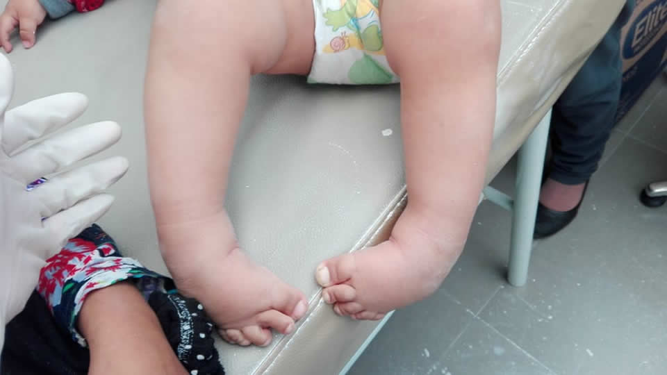 Proyecto Cambiando Vidas - Banco de férulas